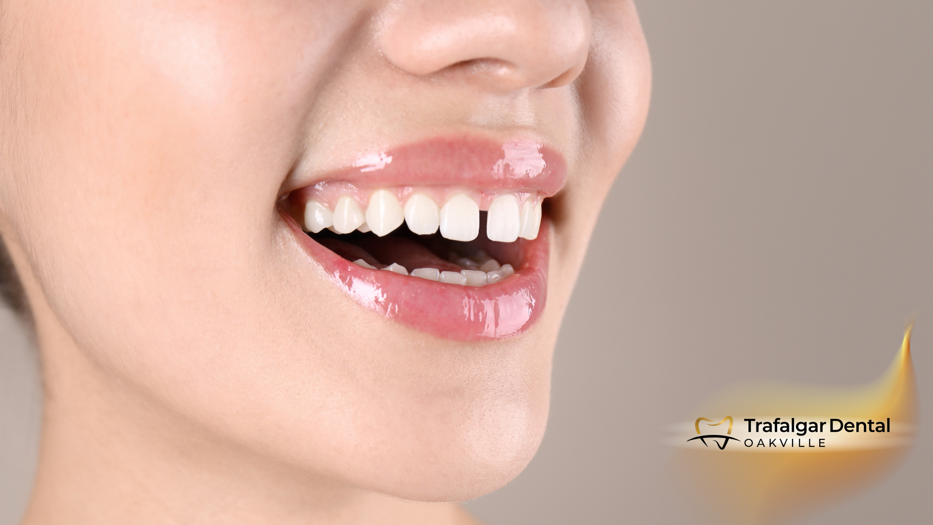 A close up of a woman 's teeth with her mouth open.
