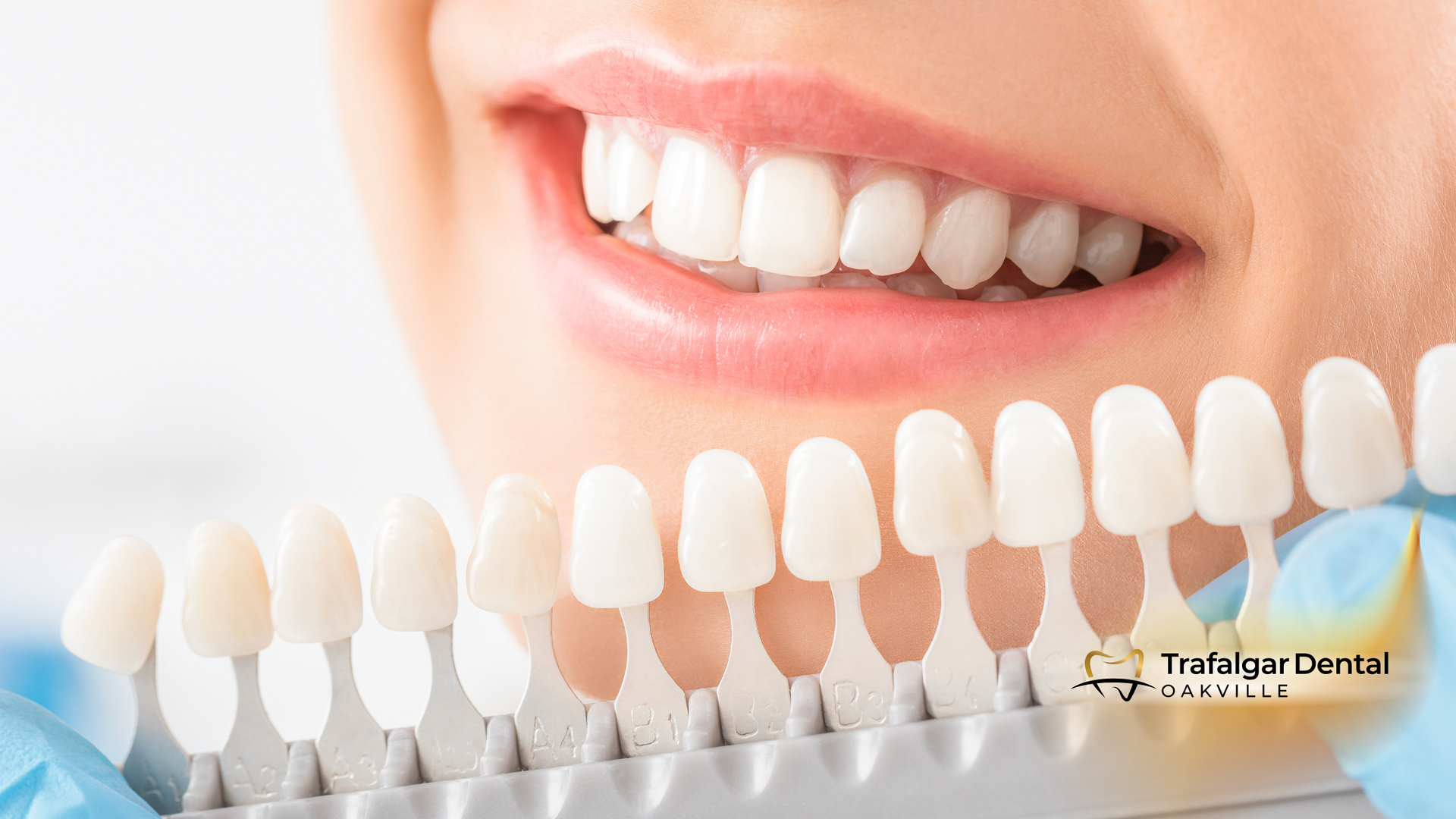 A woman is getting her teeth whitened by a dentist.