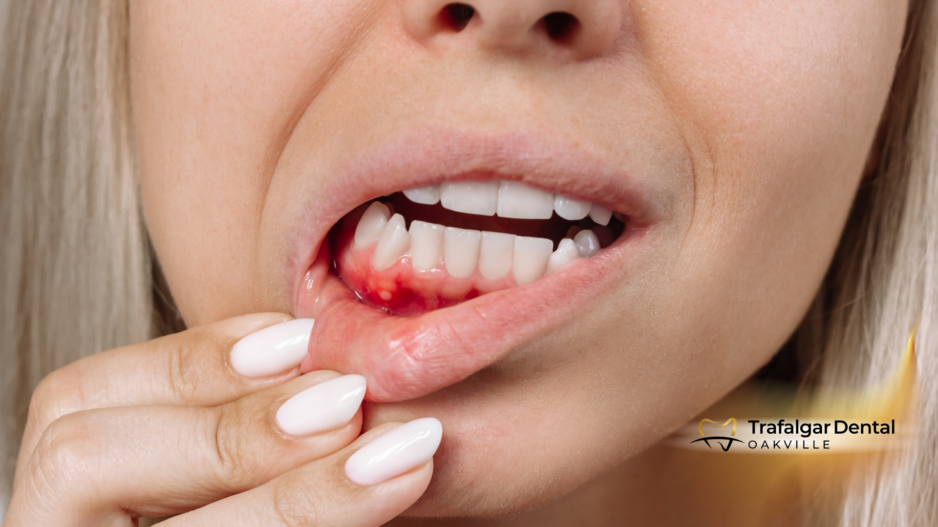 a woman with bleeding gums
