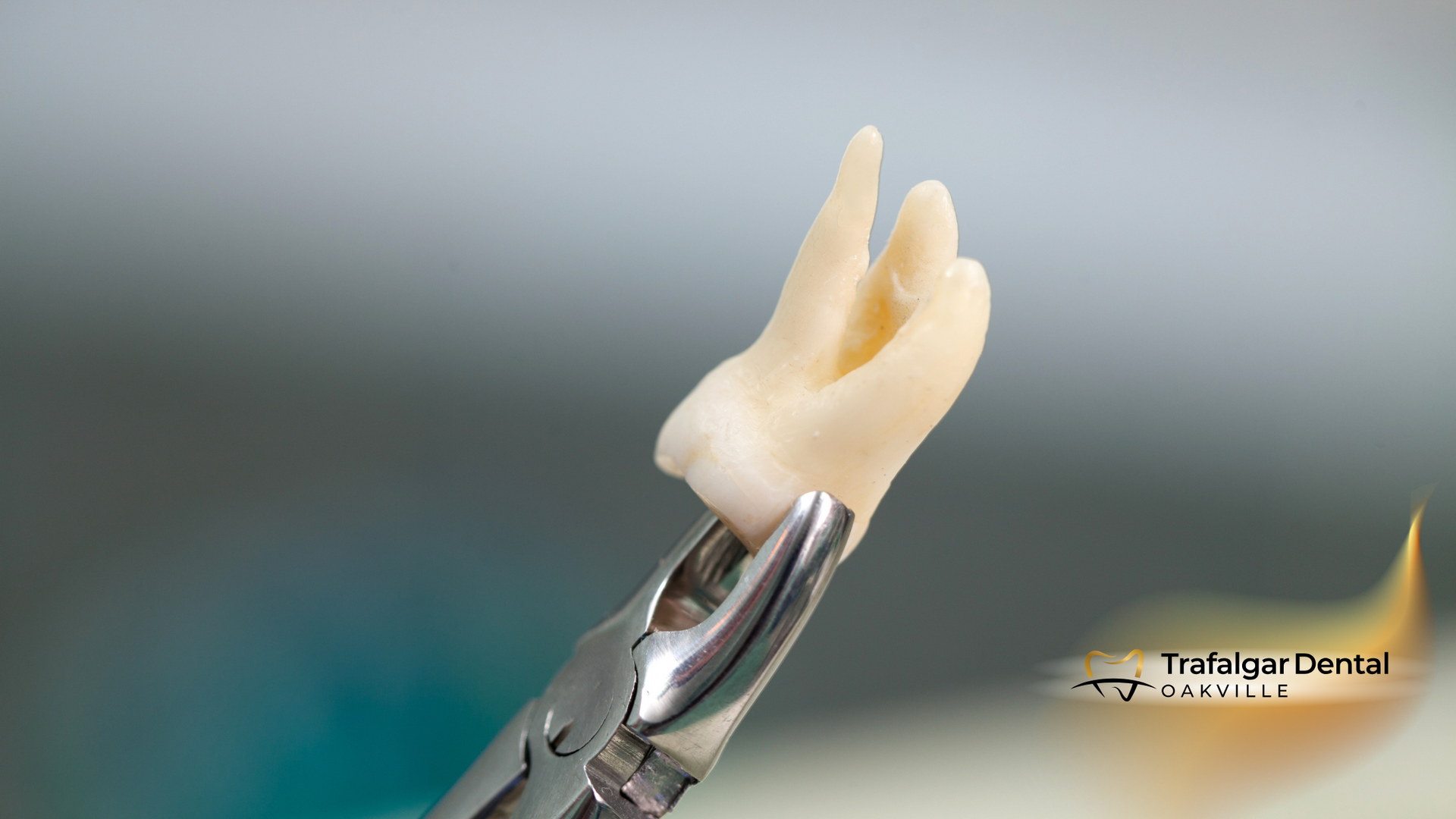 A close up of a tooth in a dental pliers.