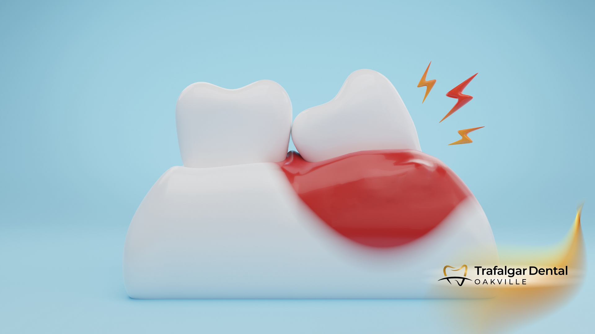 A 3d rendering of a tooth with a toothache.