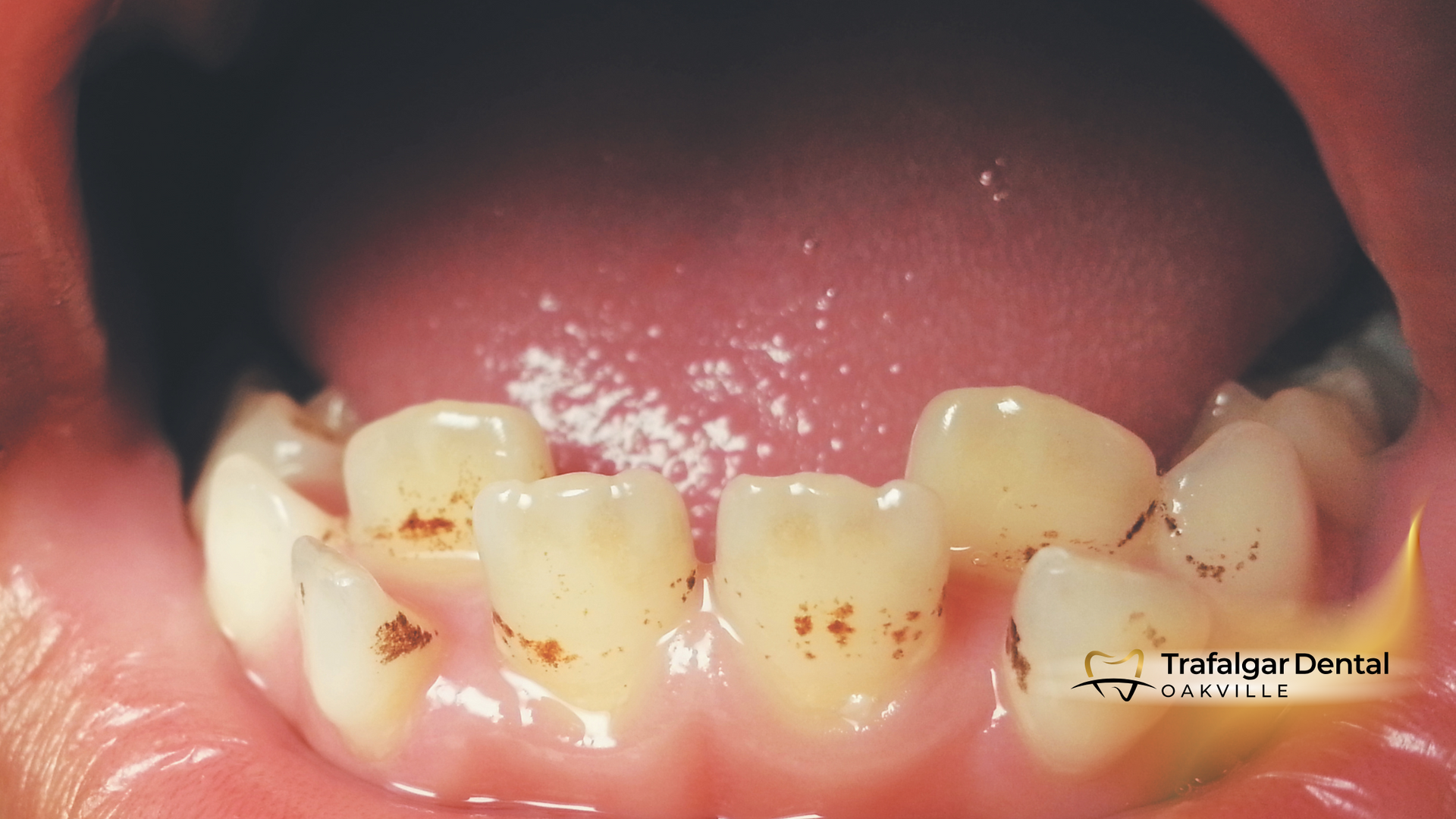 A close up of a person 's mouth showing their teeth