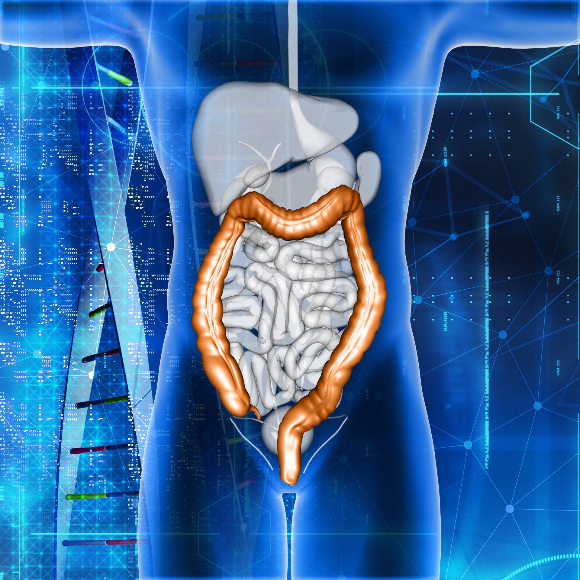 O que é o câncer de intestino? O que é o câncer de intestino?