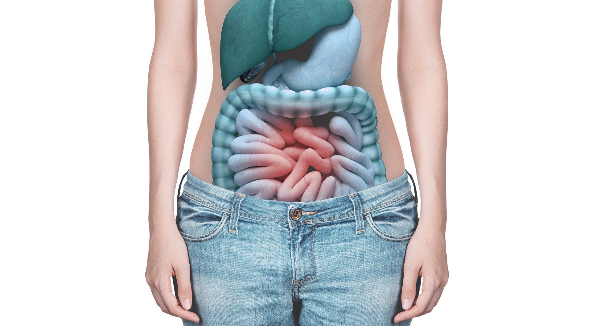 Síndrome do intestino irritável O que é síndrome do intestino irritável?