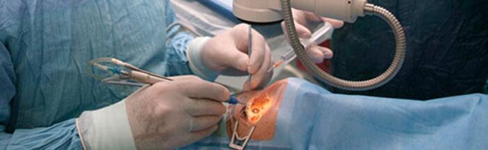 DR. EVERARDO HERNANDEZ- Degeneración Macular