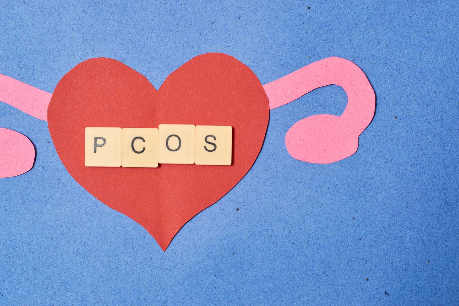 Concept polycystic ovary syndrome, PCOS Concept polycystic ovary syndrome, PCOS