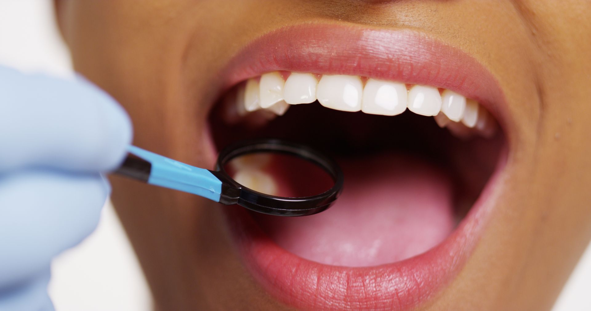 Close-up of a dental mirror examining an open mouth and clean teeth