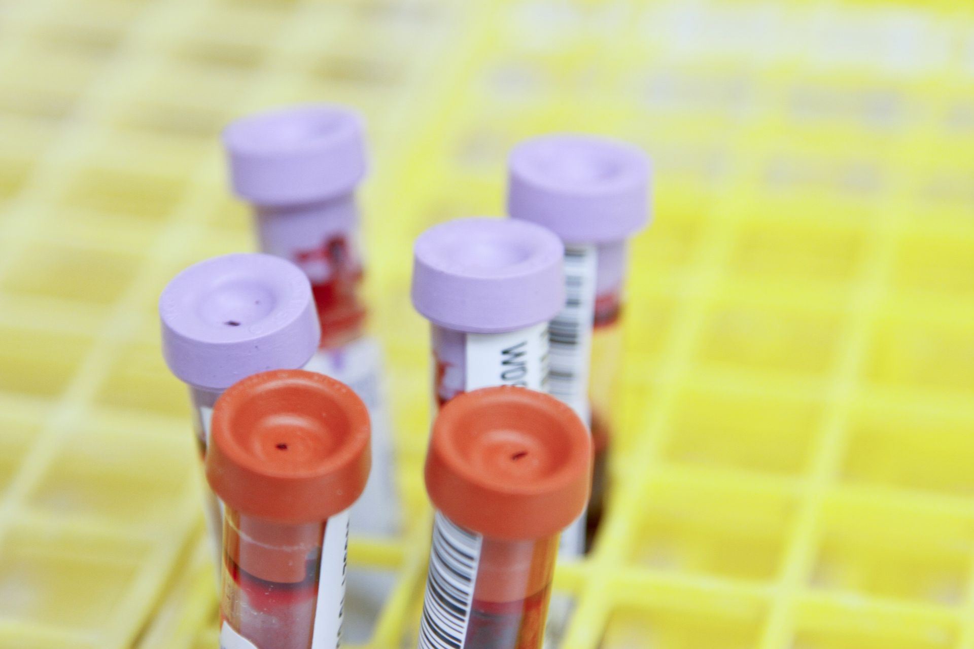 Laboratory test tubes with purple and orange caps in a yellow rack