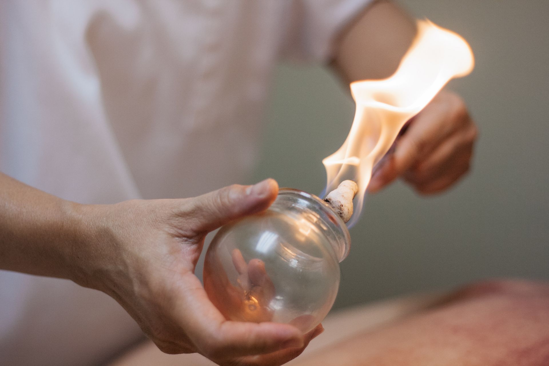 A practitioner holds a glass cup with a flaming cotton swab inside to prepare it for fire cupping therapy.