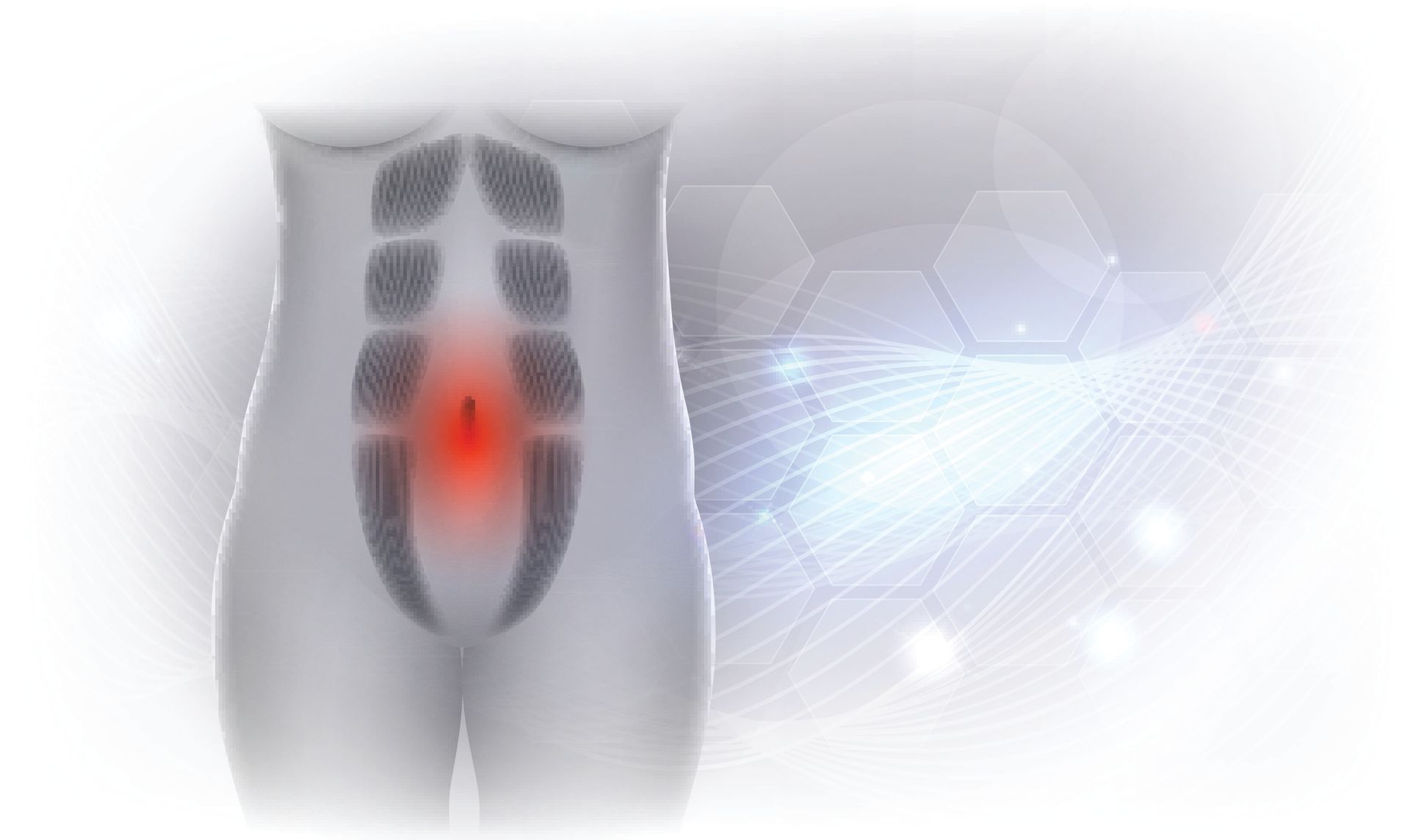 Abdominoplastia em SP Abdominoplastia em SP