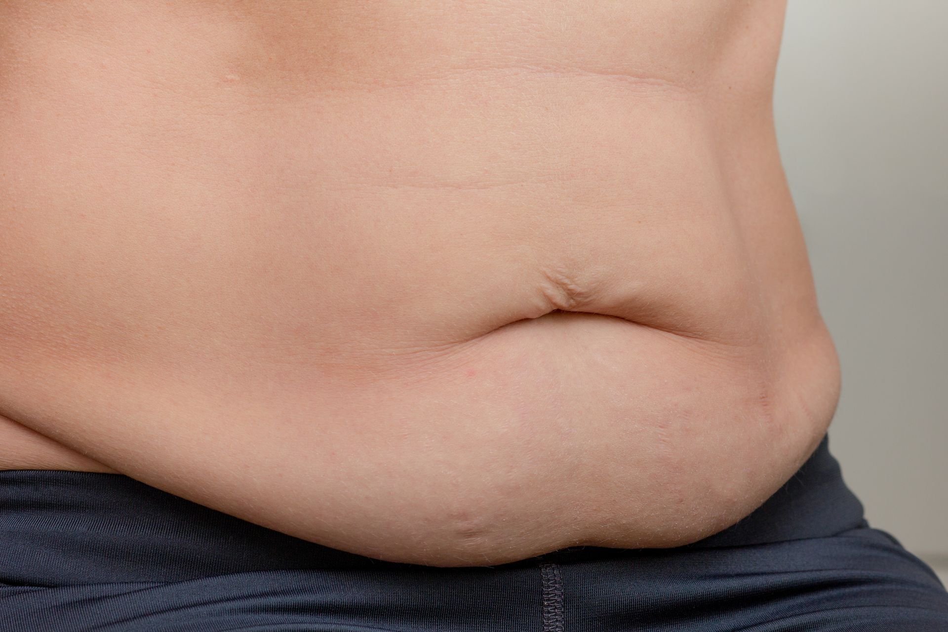 Diástase Abdominal: Cirurgia Robótica É a Melhor Opção Diástase Abdominal: Cirurgia Robótica É a Melhor Opção
