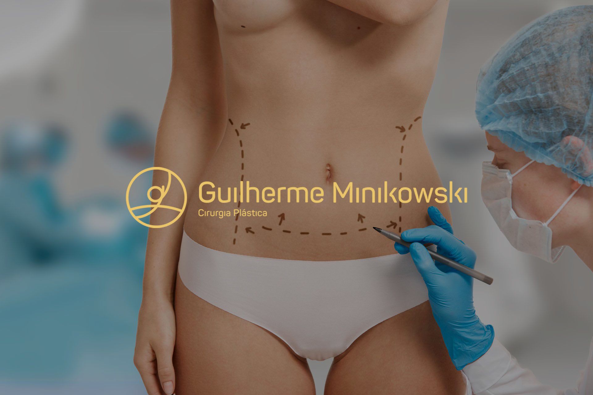 Como é feita a cirurgia de Mila