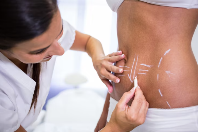 Como é feito o argoplasma Como é feito o argoplasma