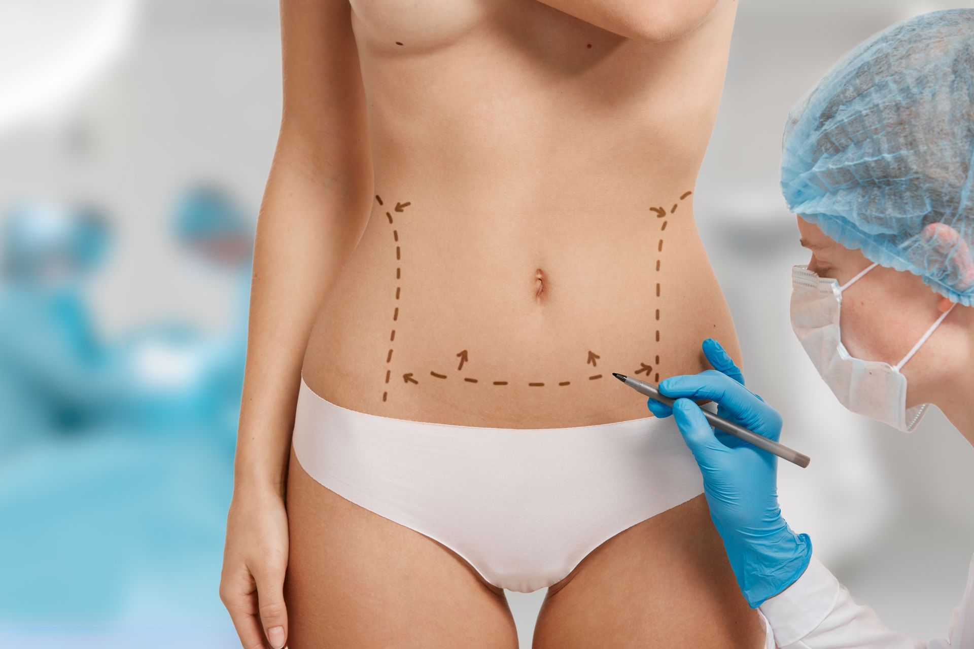 Como funciona a recuperaco da lipoabdominoplastia minimamente invasiva MILA Como funciona a recuperacao da lipoabdominoplastia minimamente invasiva MILA