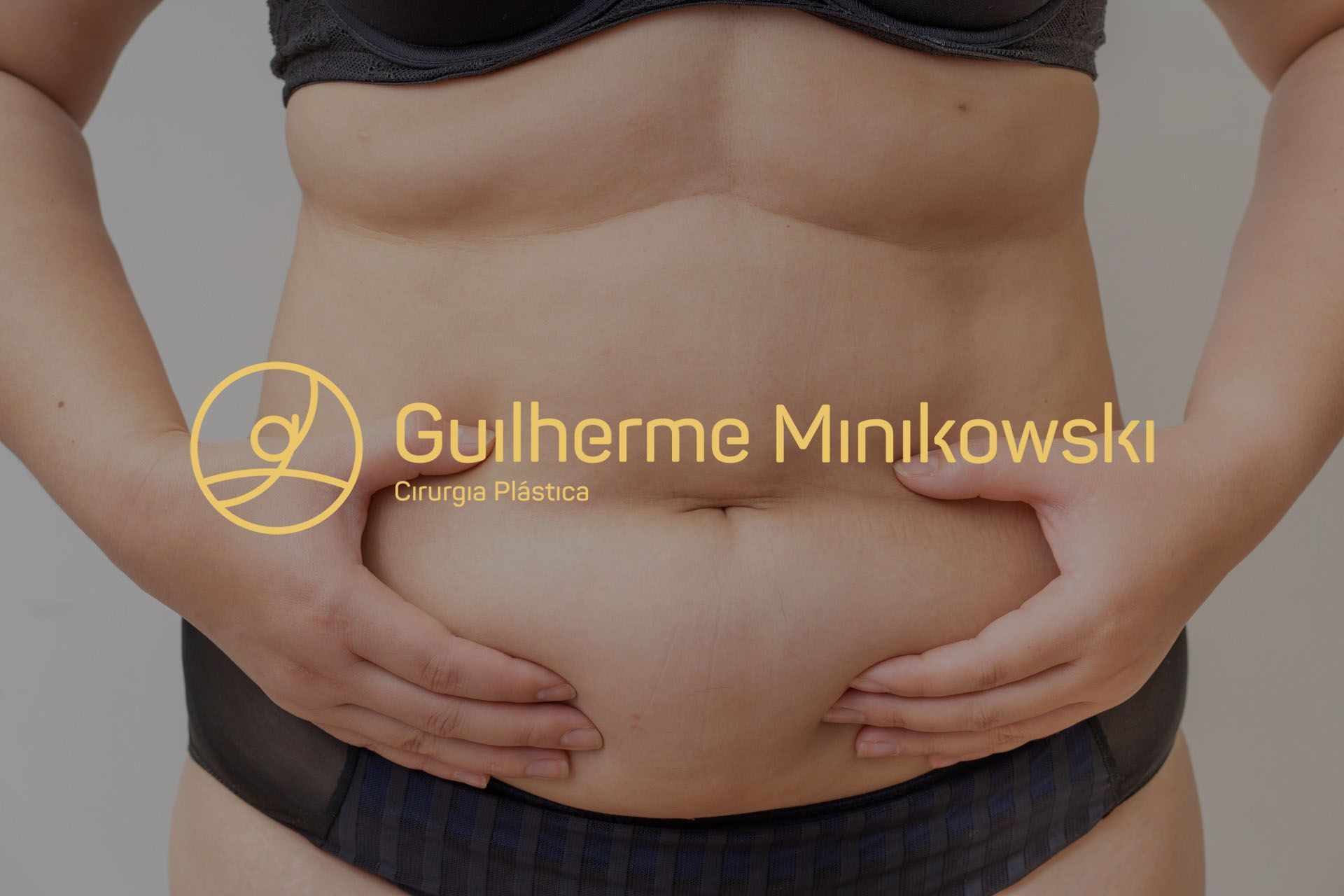 O que é a abdominoplastia O que é a abdominoplastia