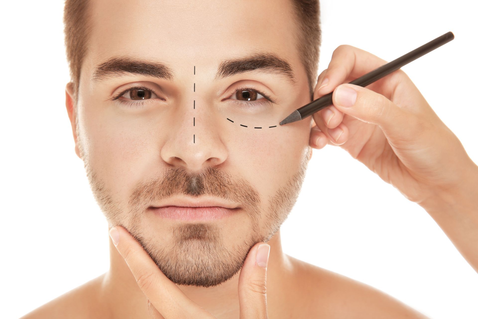 O que e a blefaroplastia