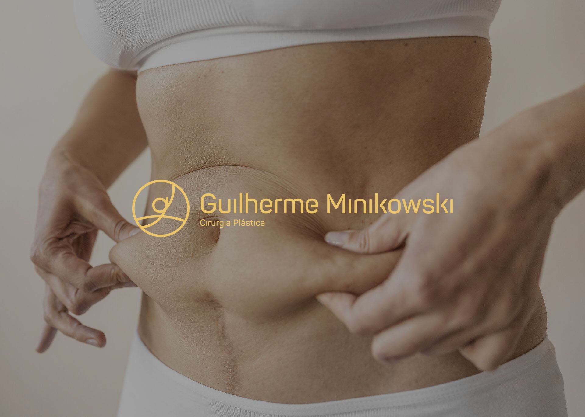 Para quem é indicada a cirurgia de Mila