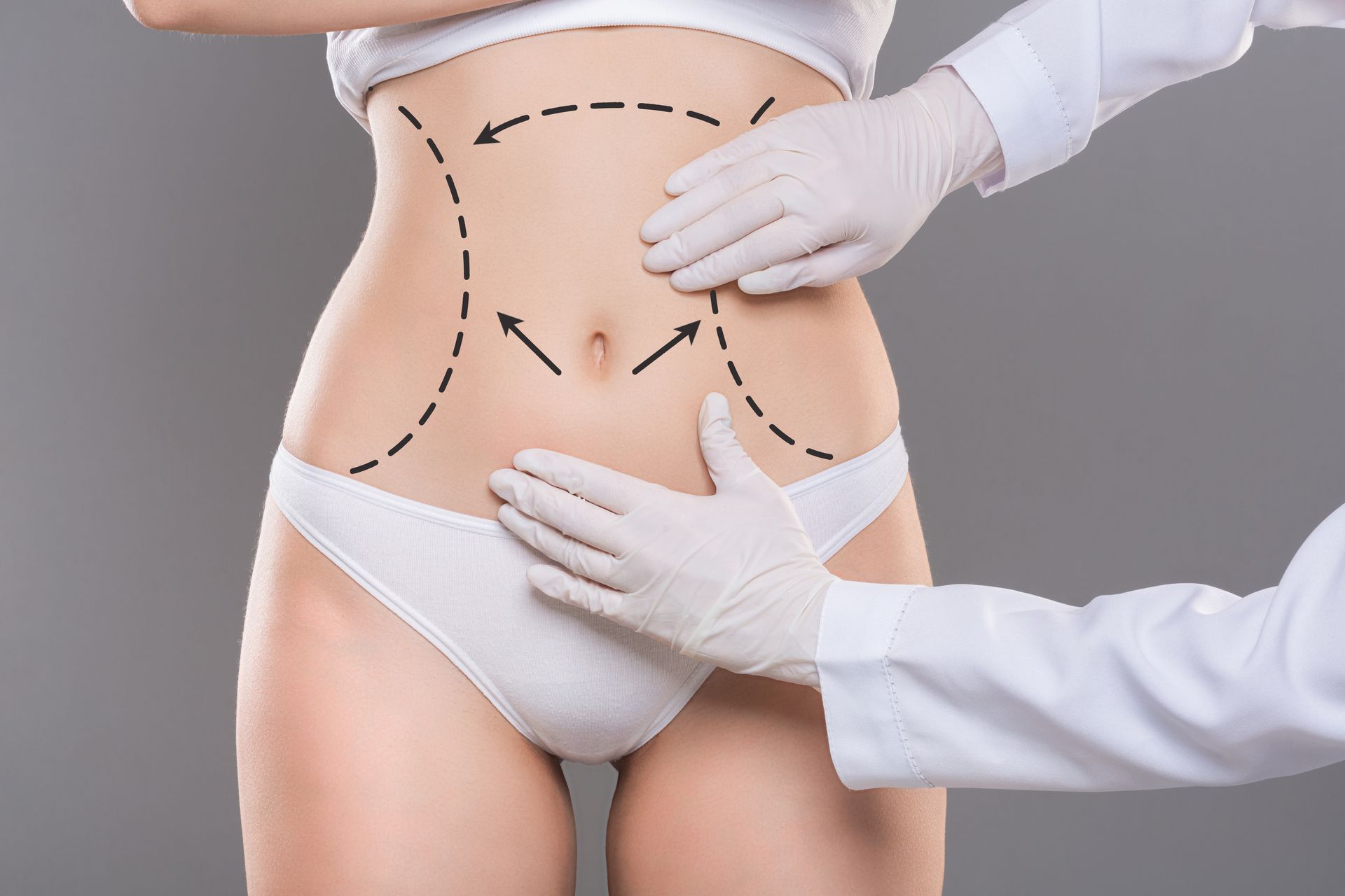 diferença de abdominoplastia e Lipoabdominoplastia