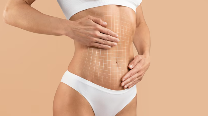 Qual o peso ideal para fazer a lipoabdominoplastia Qual o peso ideal para fazer a lipoabdominoplastia