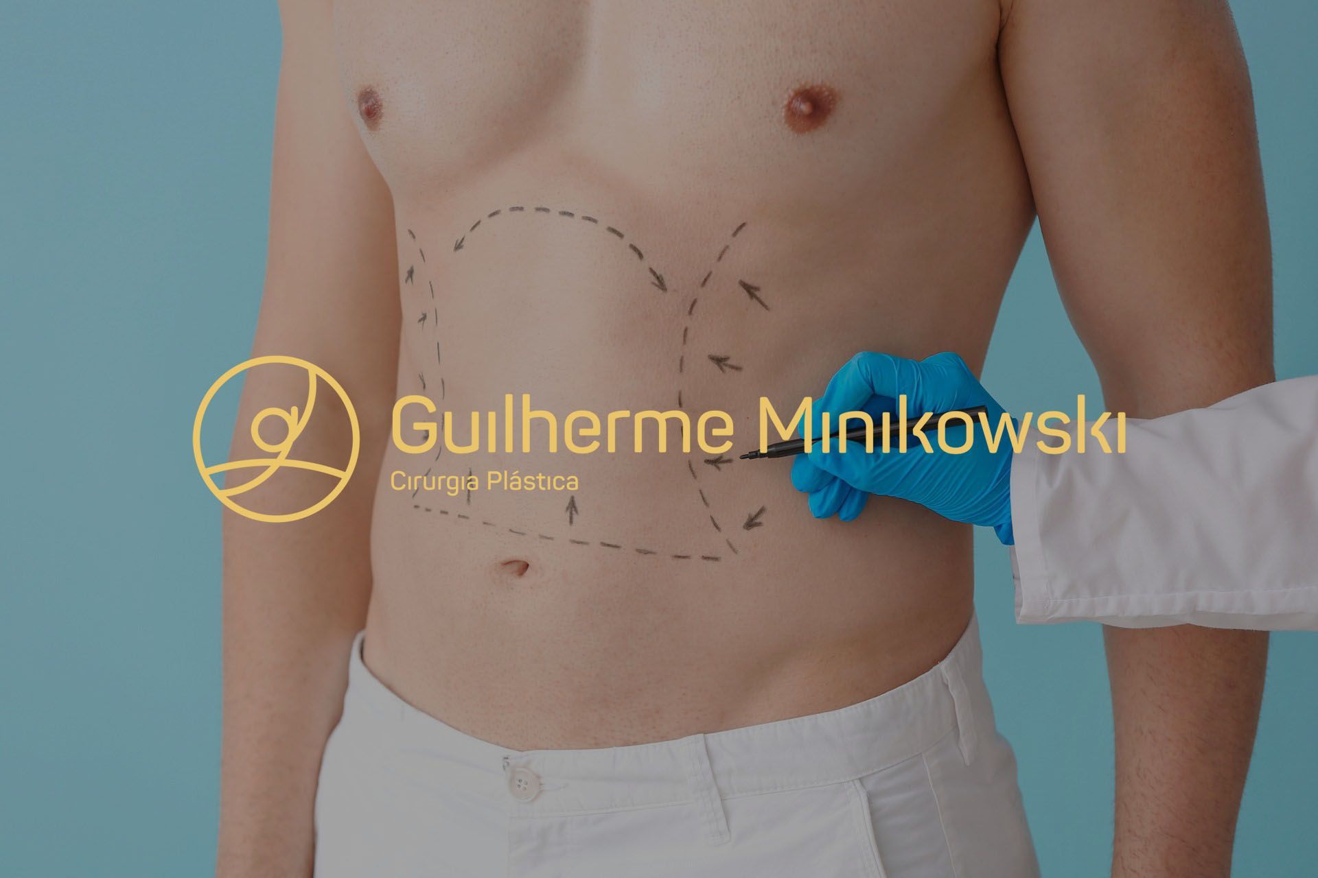 Quanto tempo dura a abdominoplastia Quanto tempo dura a abdominoplastia