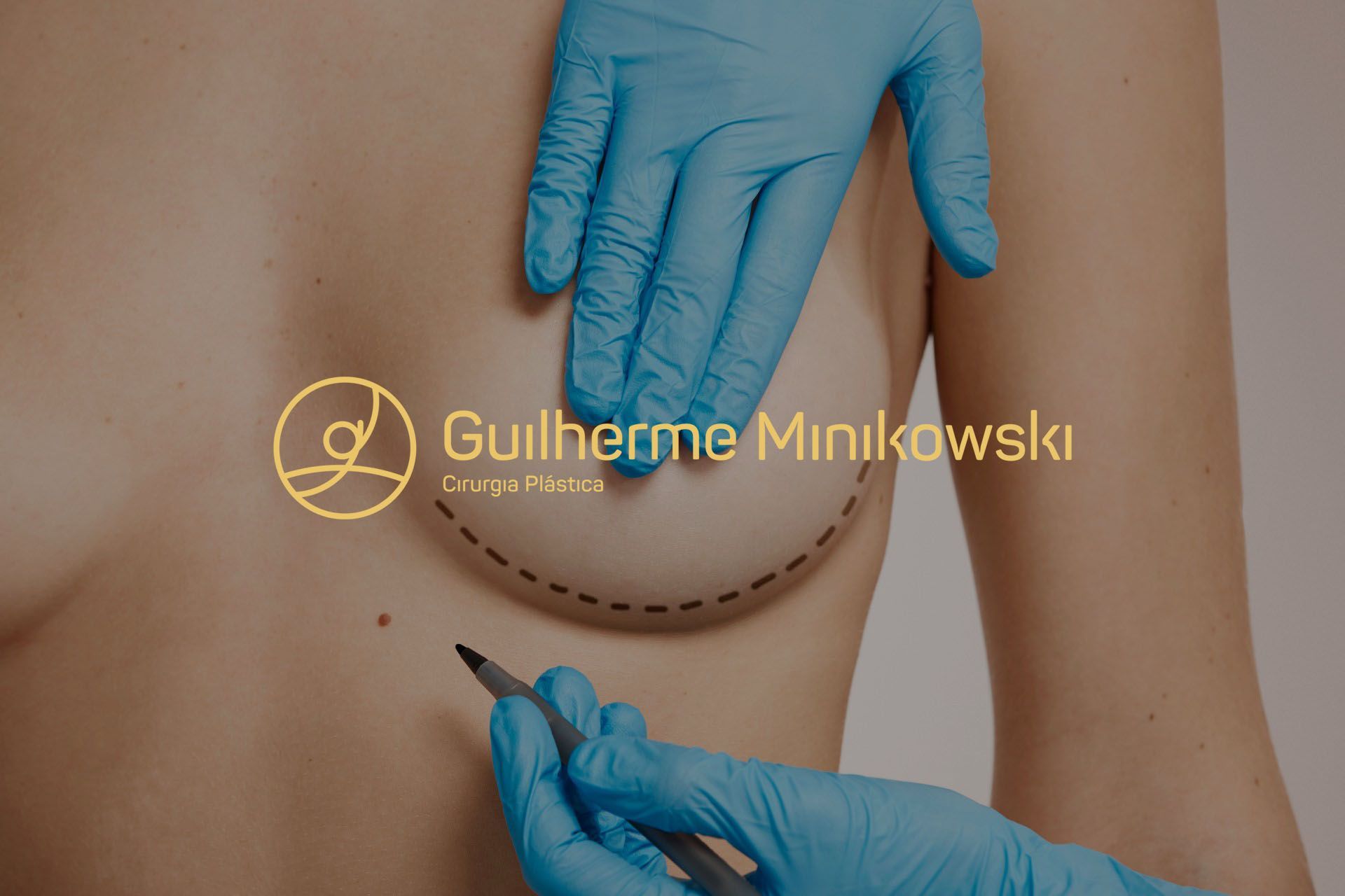Como é feita a cirurgia R24R Como é feita a cirurgia R24R