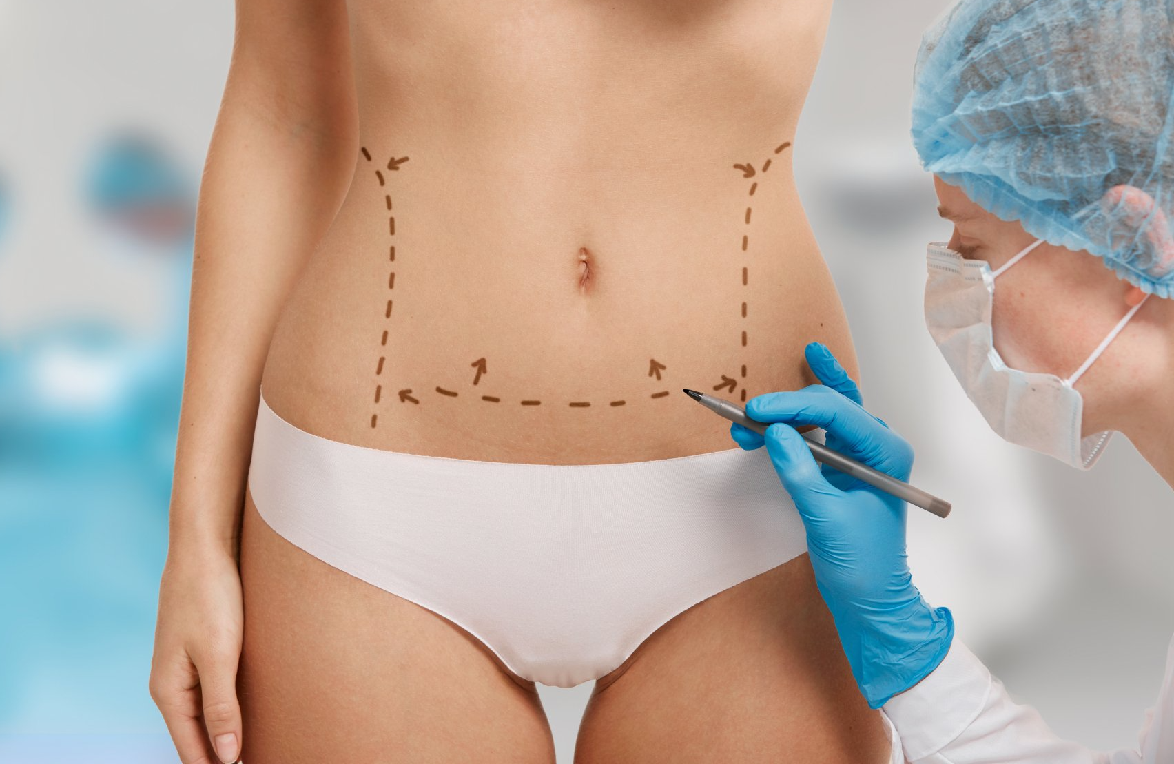 Como a lipoaspiração a laser é feita