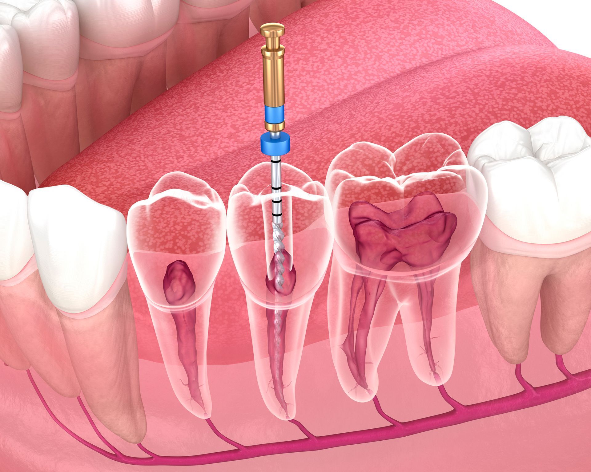 endodonzia