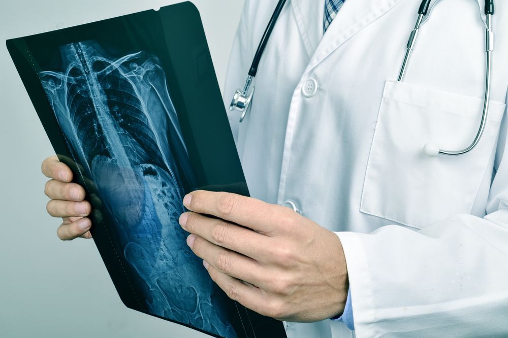 Doctor in white coat examines a chest X-ray, stethoscope around his neck.