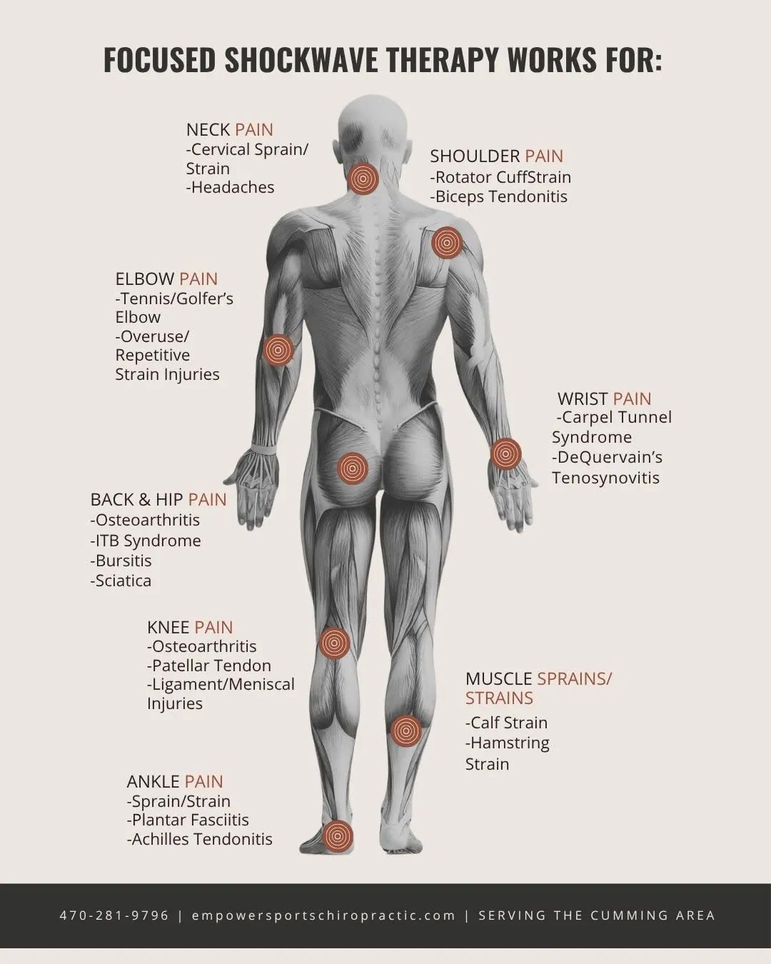 Infographic of body pain points for focused shockwave therapy, with a gray human figure and labeled sore areas.