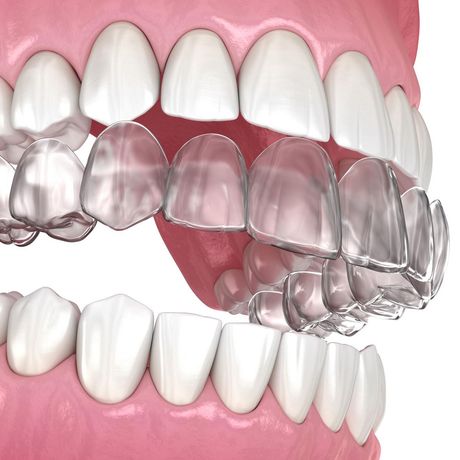 SureSmile® Alexandria VA