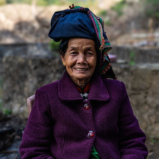 Woman in midlife considering labia majora augmentation after menopause, Hommage Women's Clinic, Gangnam, Seoul