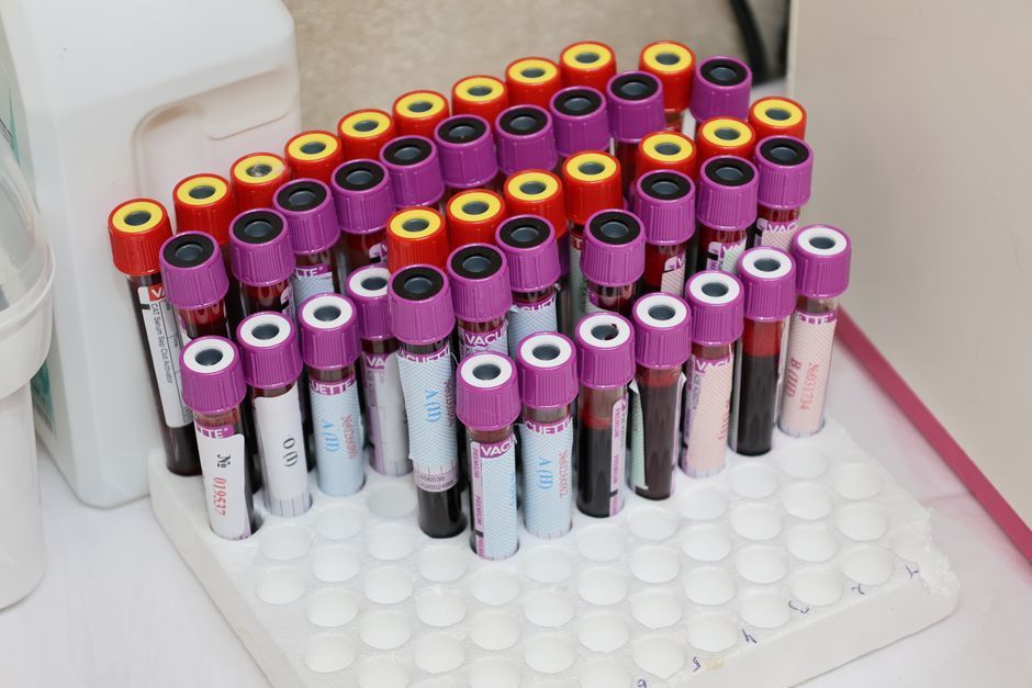 Specimen vials for liquid-based Pap smear cytology, Hommage Women's Clinic, Gangnam, Seoul