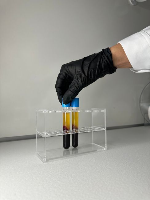 Sterile blood sample tubes for O-Shot PRP preparation at Hommage Women's Clinic, Gangnam, Seoul