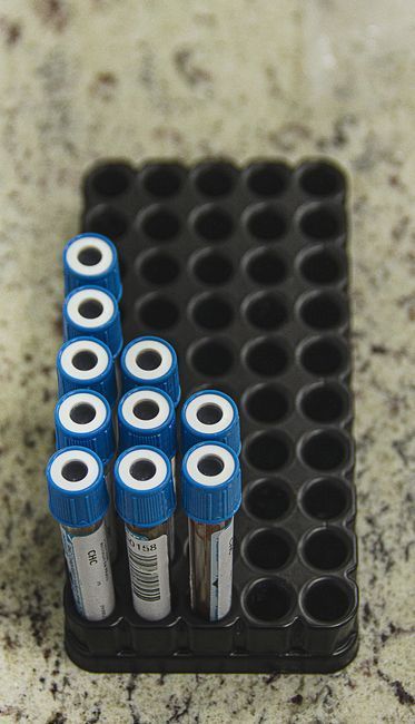 Blood sample tubes for premarital health check tests, Hommage Women's Clinic, Gangnam, Seoul