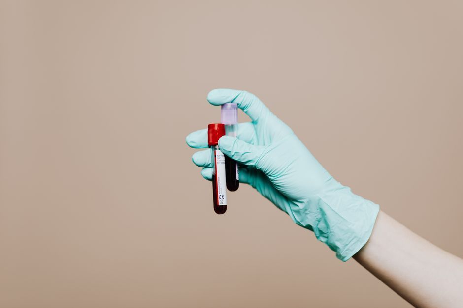 Blood sample tubes for PRP vaginal rejuvenation preparation, Hommage Women's Clinic, Gangnam, Seoul