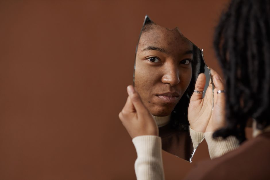 Woman checking hormonal acne in a mirror, a common PCOS symptom, Hommage Women's Clinic, Gangnam, Seoul