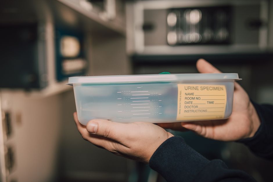 Urine sample for UTI testing at Hommage Women's Clinic, Gangnam, Seoul