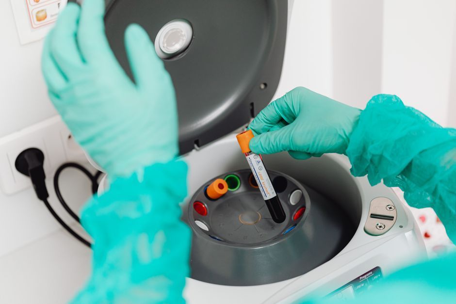 Hormone blood test samples for irregular periods, analysed for Hommage Women's Clinic, Gangnam, Seoul