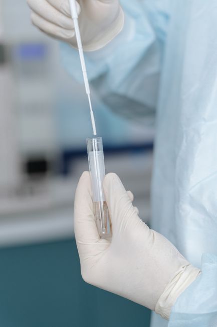 Swab test kit used for STD PCR testing at Hommage Women's Clinic, Gangnam, Seoul
