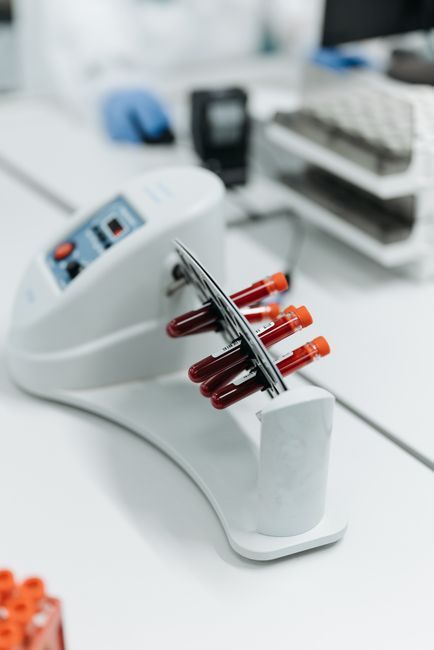 Laboratory centrifuge used to prepare platelet-rich plasma for the O-Shot, Hommage Women's Clinic, Gangnam, Seoul