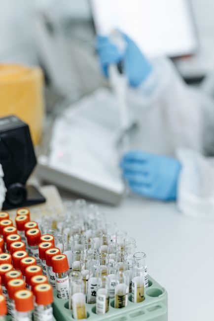 Laboratory pipette and tubes for HPV DNA testing, Hommage Women's Clinic, Gangnam, Seoul