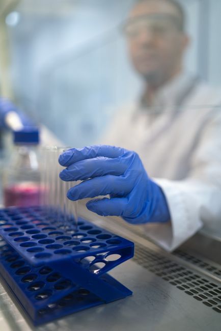 Laboratory test tubes for urine culture in UTI treatment at Hommage Women's Clinic, Gangnam, Seoul