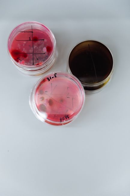 Laboratory culture testing for recurrent vaginal infections at Hommage Women's Clinic, Gangnam, Seoul