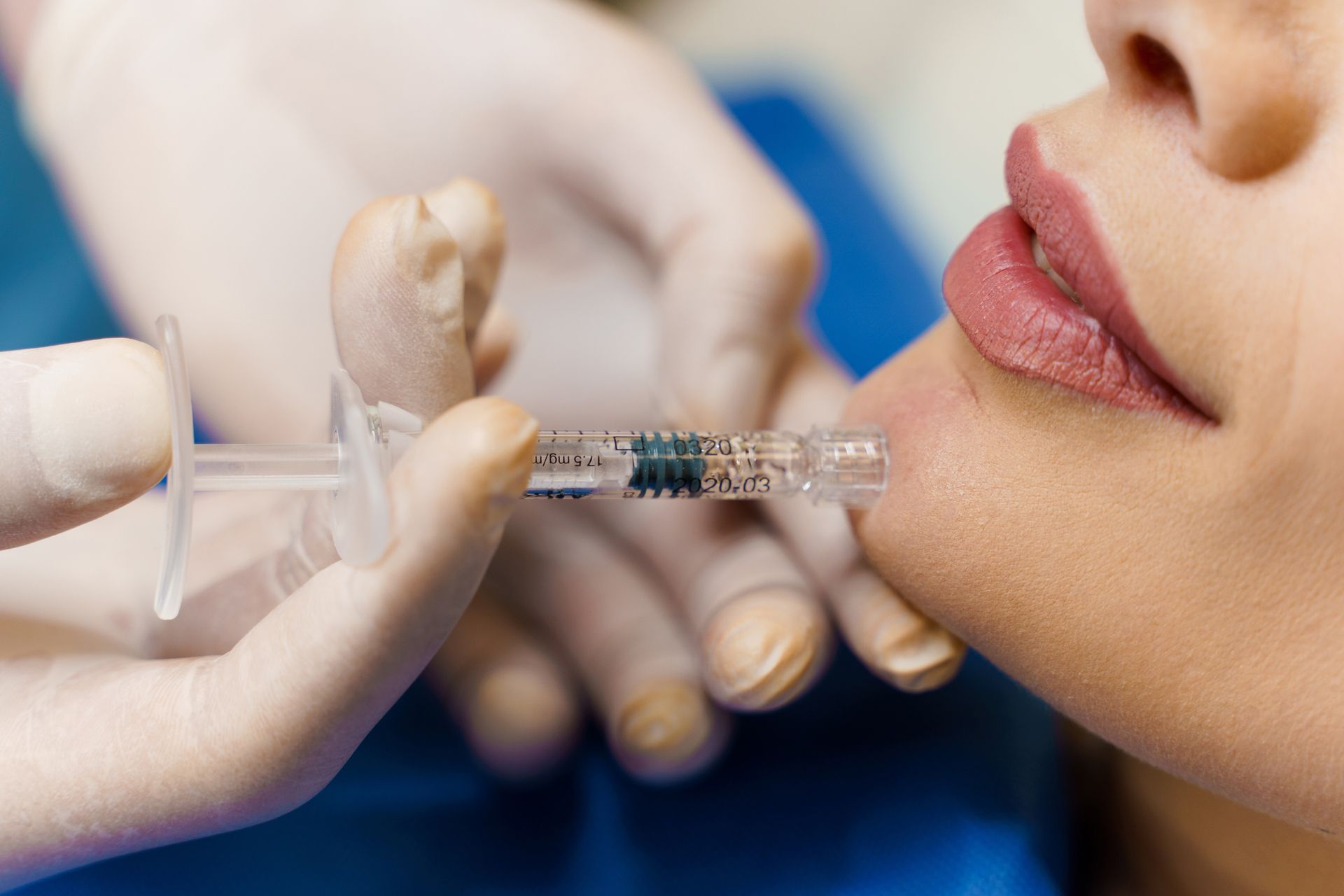 Filler Injection