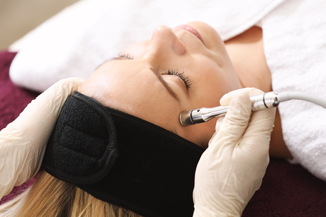 Microdermabrasion