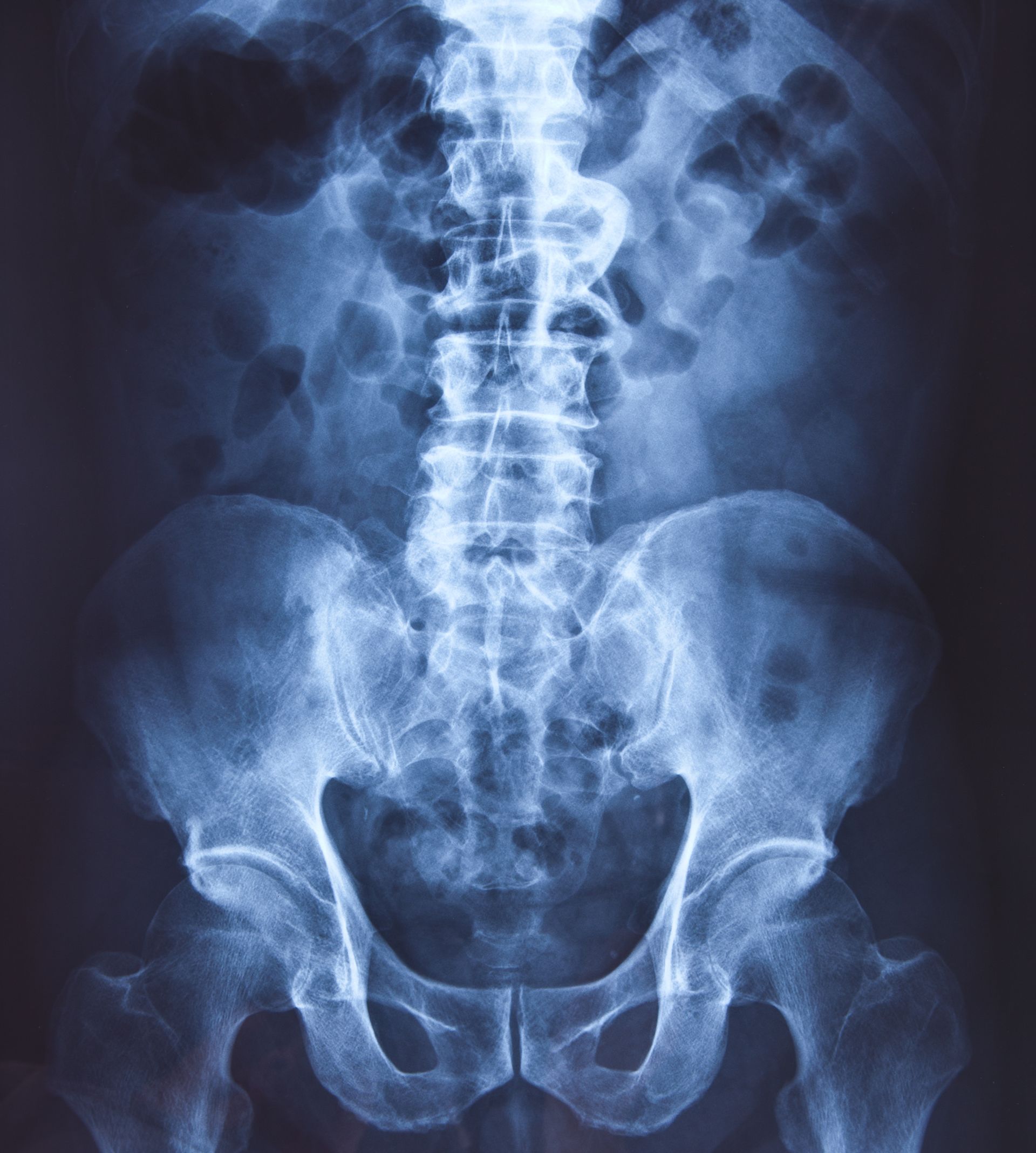 A doctor is looking at an x-ray with a patient.