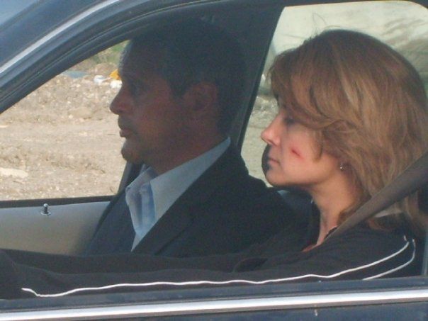 A man in a suit and a woman with a small injury on her cheek sit side-by-side inside a car.