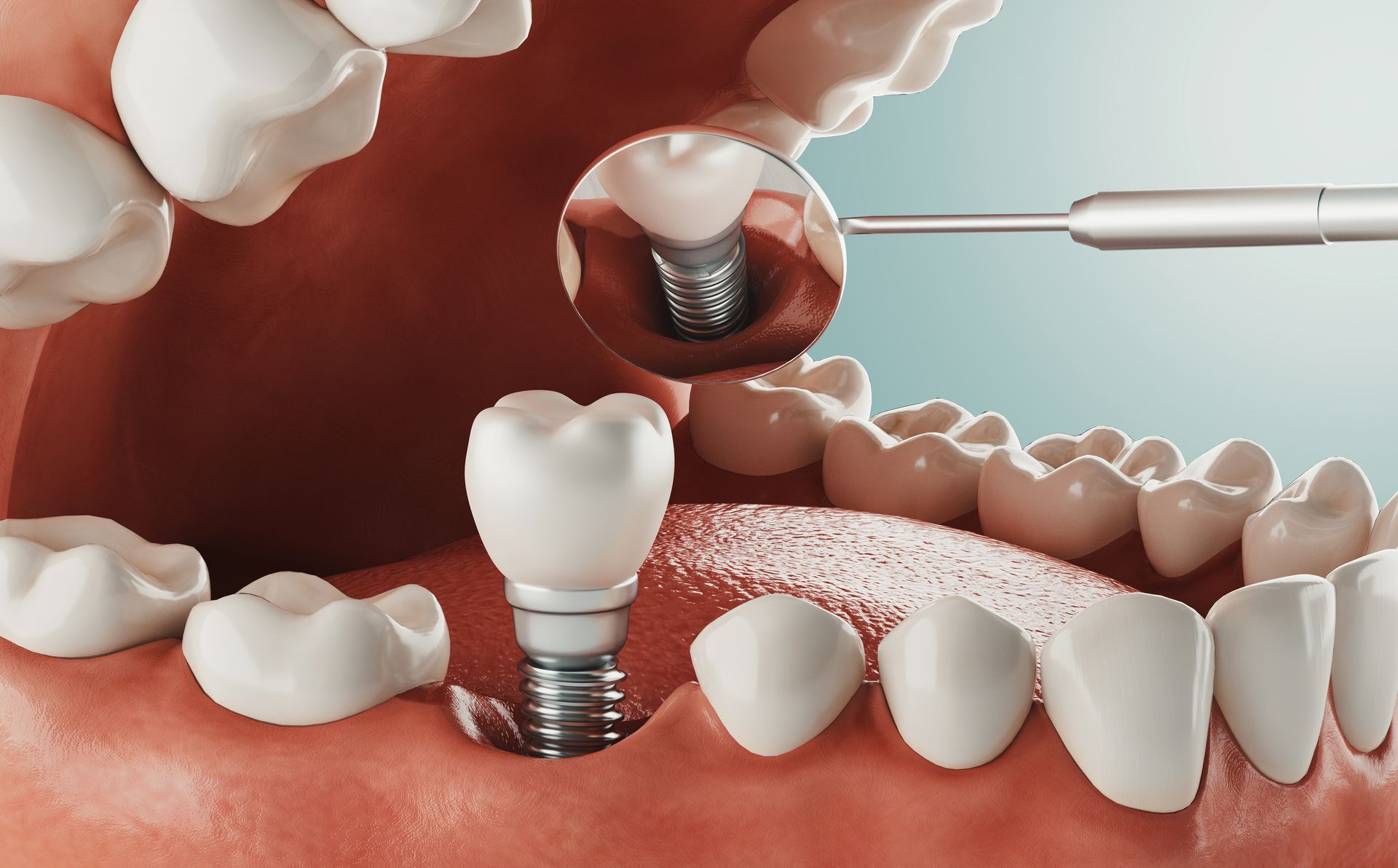 Dental Care