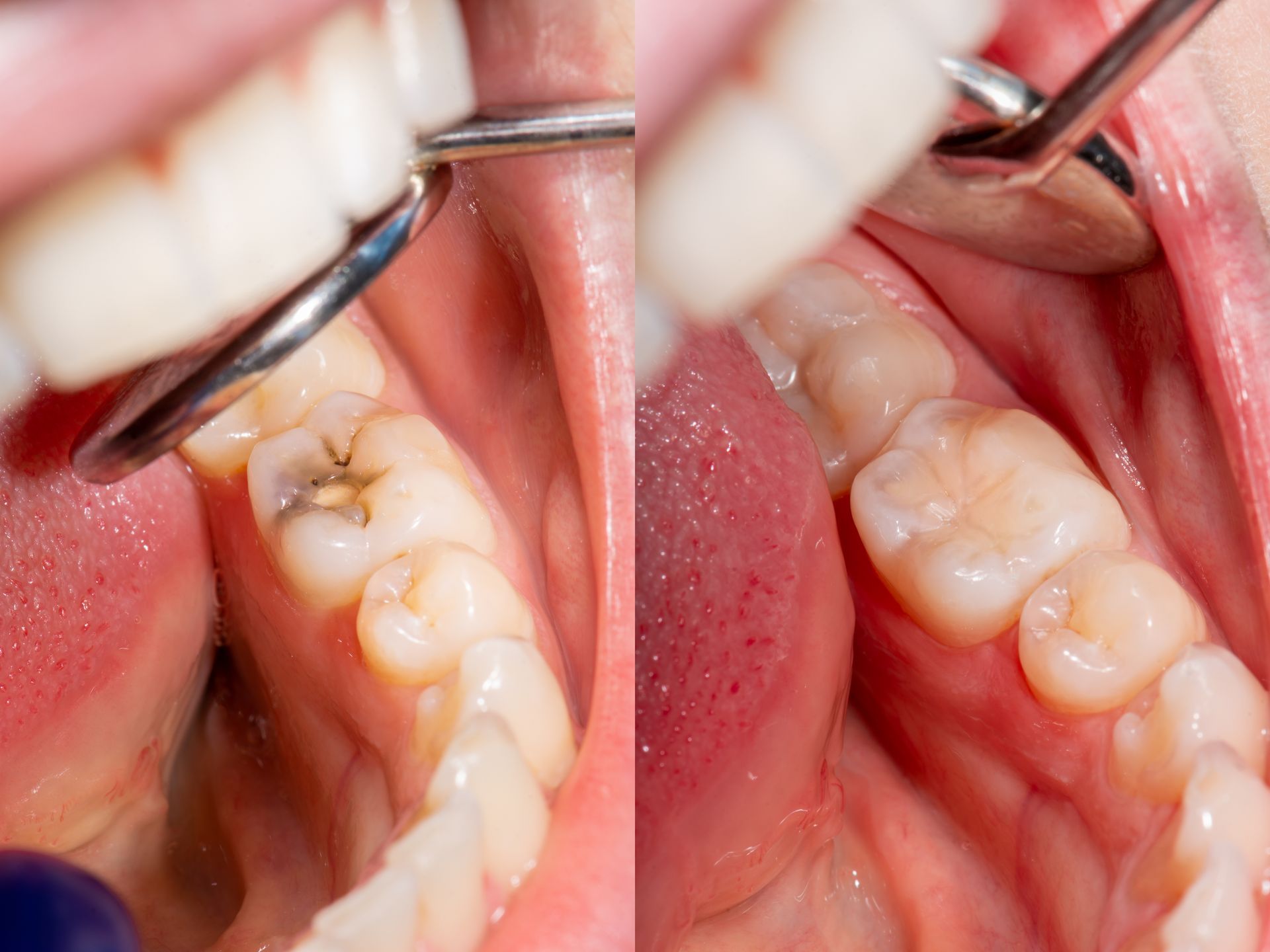 Dental Care