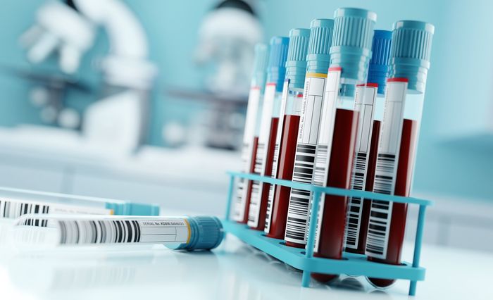 esami medici per il sangue